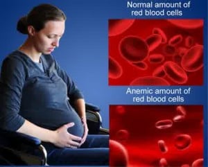 anemia pada ibu hamil source medindia net