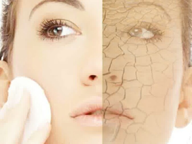 Kulit kering selama kehamilan