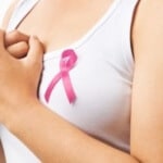 stadium kanker payudara 2