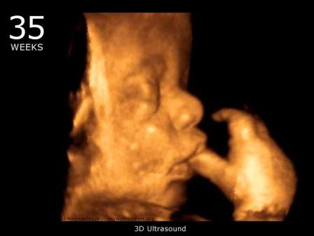hamil 35 minggu USG 4 Dimensi 2