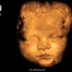 hamil 39 minggu USG 4Dimensi
