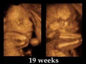 hamil 19 minggu USG 4 Dimensiii
