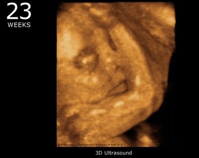 hamil 23 minggu USG 4 Dimensi