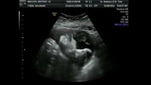 hamil 29 minggu USG 4 dimensi