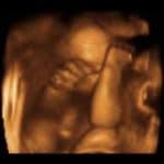 hamil 29 minggu USG 4dimensi