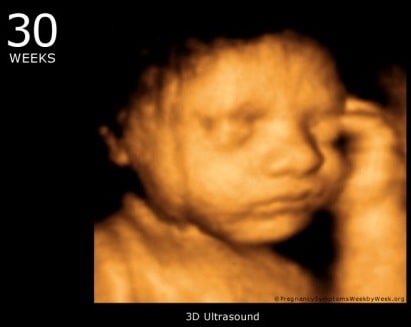 hamil 30 minggu USG 4 Dimensi