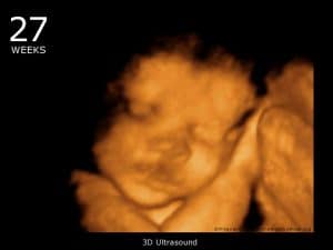 hamil 27 minggu USG 4 Dimensi